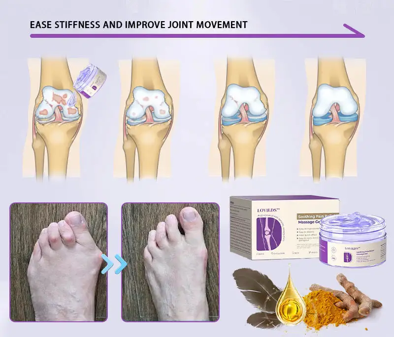 Turmeric & Emu Oil Arthritis Soothing Pain Relief Massage Gel - Image 11