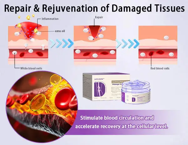 Turmeric & Emu Oil Arthritis Soothing Pain Relief Massage Gel - Image 9