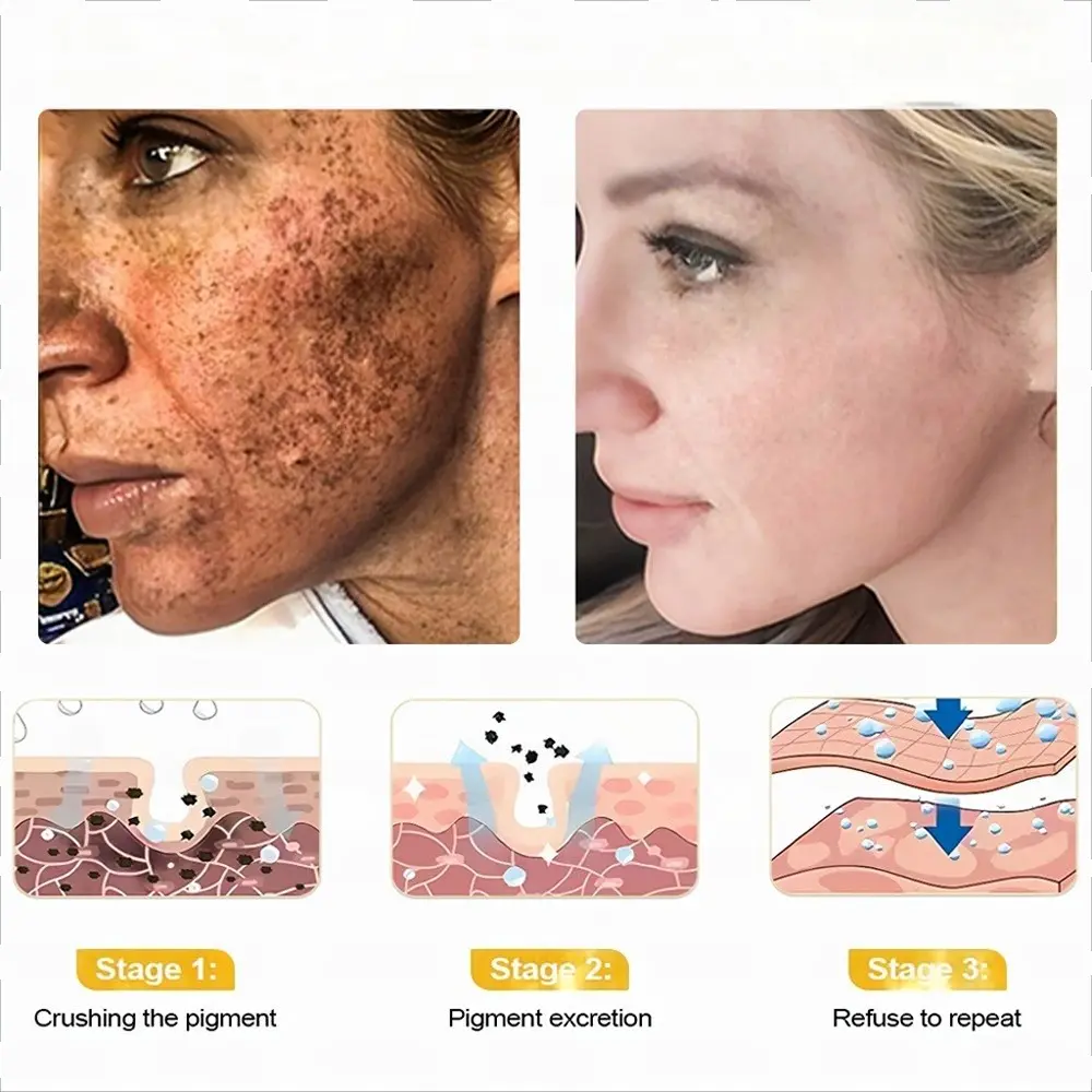 Ultimate All-Body Skin Restoration Cream - Image 5