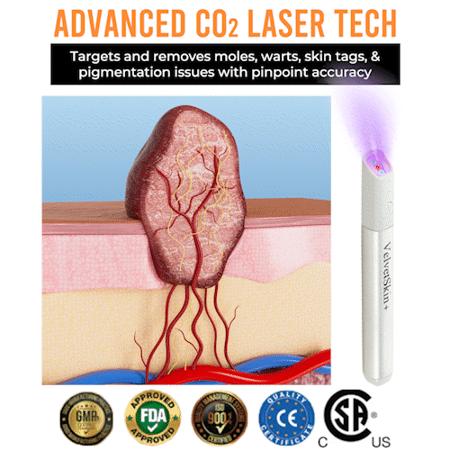 VelvetSkin+ All-in-One Laser Eraser Pen - Image 8