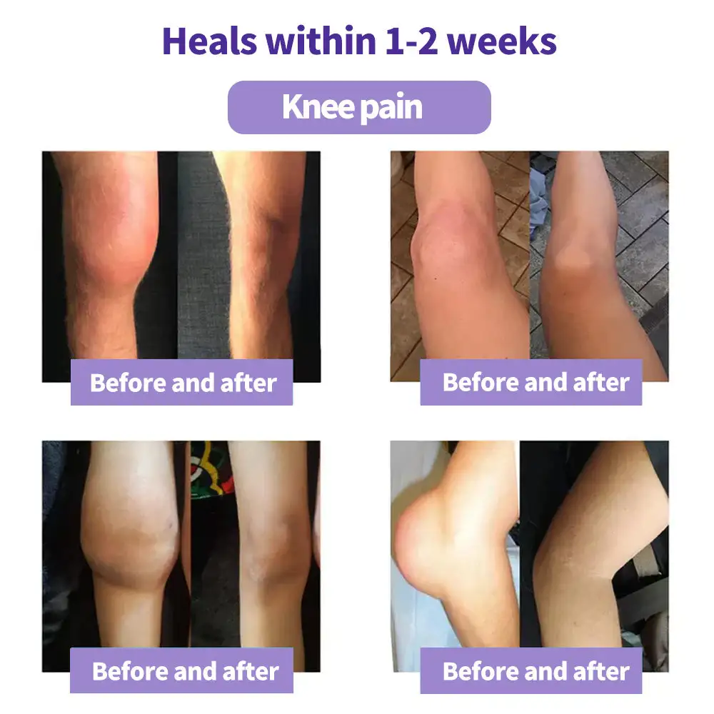 Turmeric & Emu Oil Arthritis Soothing Pain Relief Massage Gel - Image 5