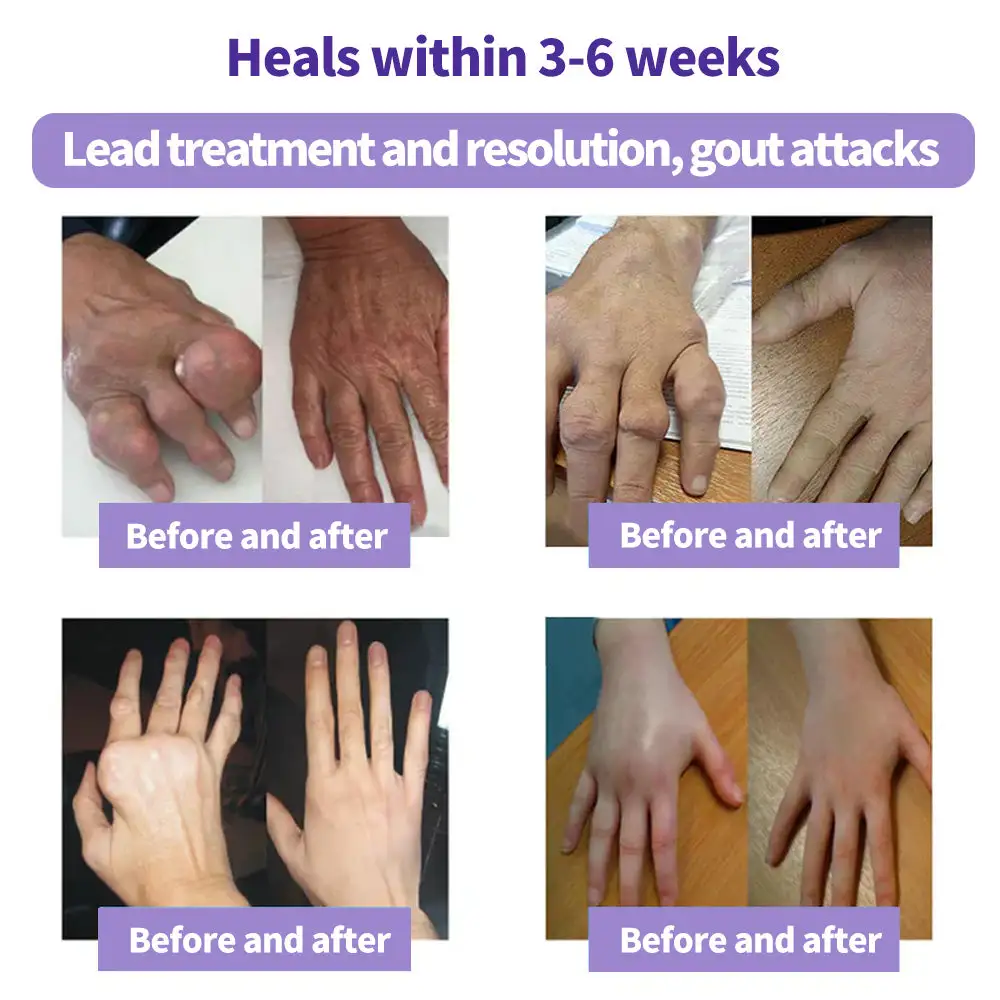 Turmeric & Emu Oil Arthritis Soothing Pain Relief Massage Gel - Image 6