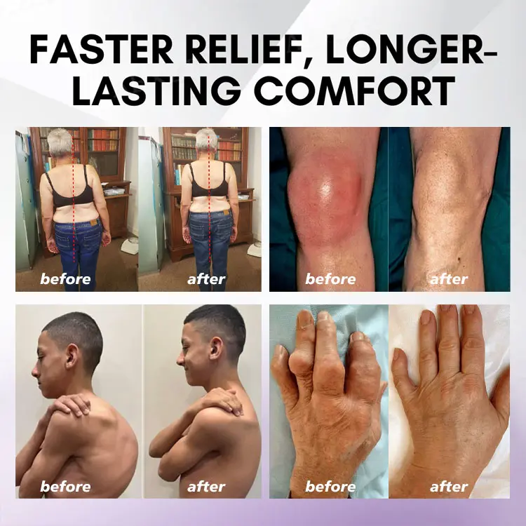 Turmeric & Emu Oil Arthritis Soothing Pain Relief Massage Gel - Image 3