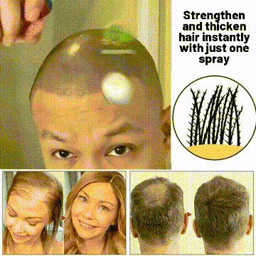 LOVILDS Natural Hair Regrowth Spray - Image 11