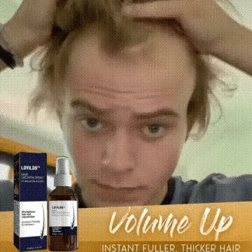 LOVILDS Natural Hair Regrowth Spray - Image 12