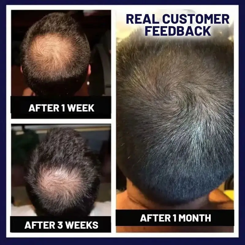 LOVILDS Natural Hair Regrowth Spray - Image 5