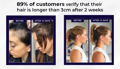 LOVILDS Natural Hair Regrowth Spray - Image 8