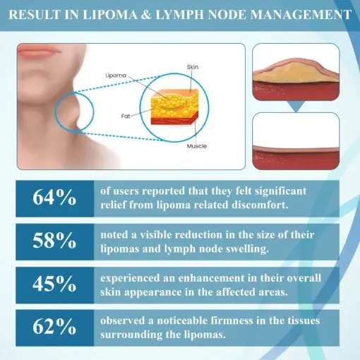LumpsClear Lymph Say Goodbye to Lipomas and Swelling - Image 9