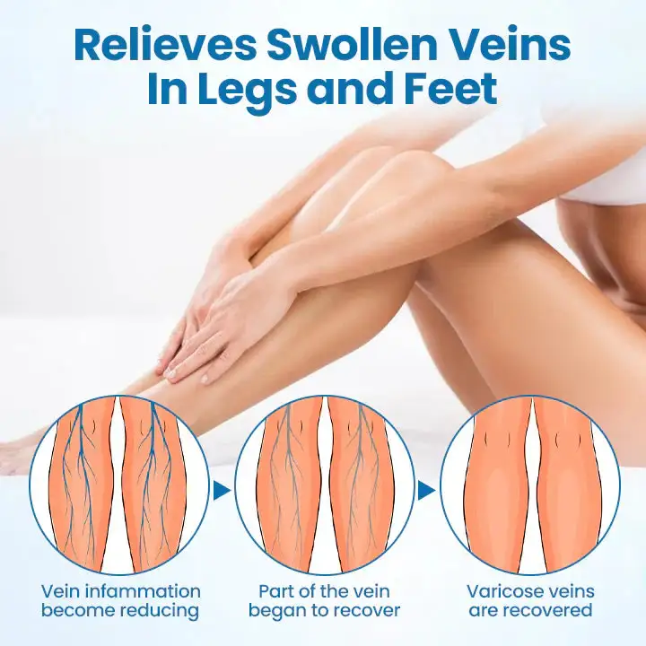 VeinGuard Herbal Spray - Image 7