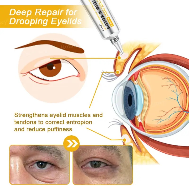 Botox Bee Venom Wrinkle Removal Cream - Image 10