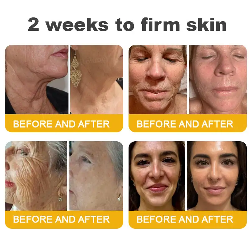 Botox Bee Venom Wrinkle Removal Cream - Image 6