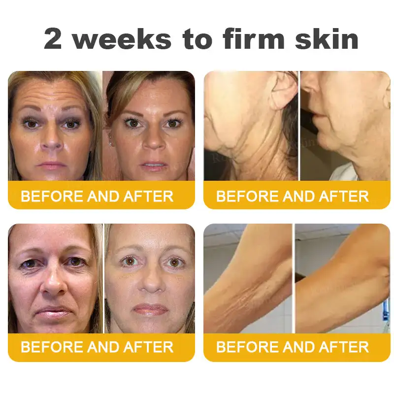 Botox Bee Venom Wrinkle Removal Cream - Image 7