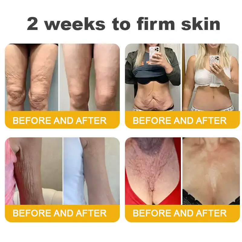 Botox Bee Venom Wrinkle Removal Cream - Image 8