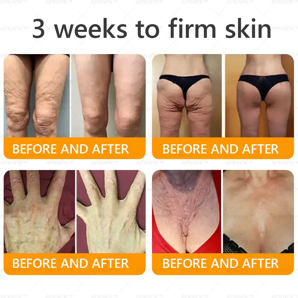 Bee venom Comprehensive Cream - Image 2