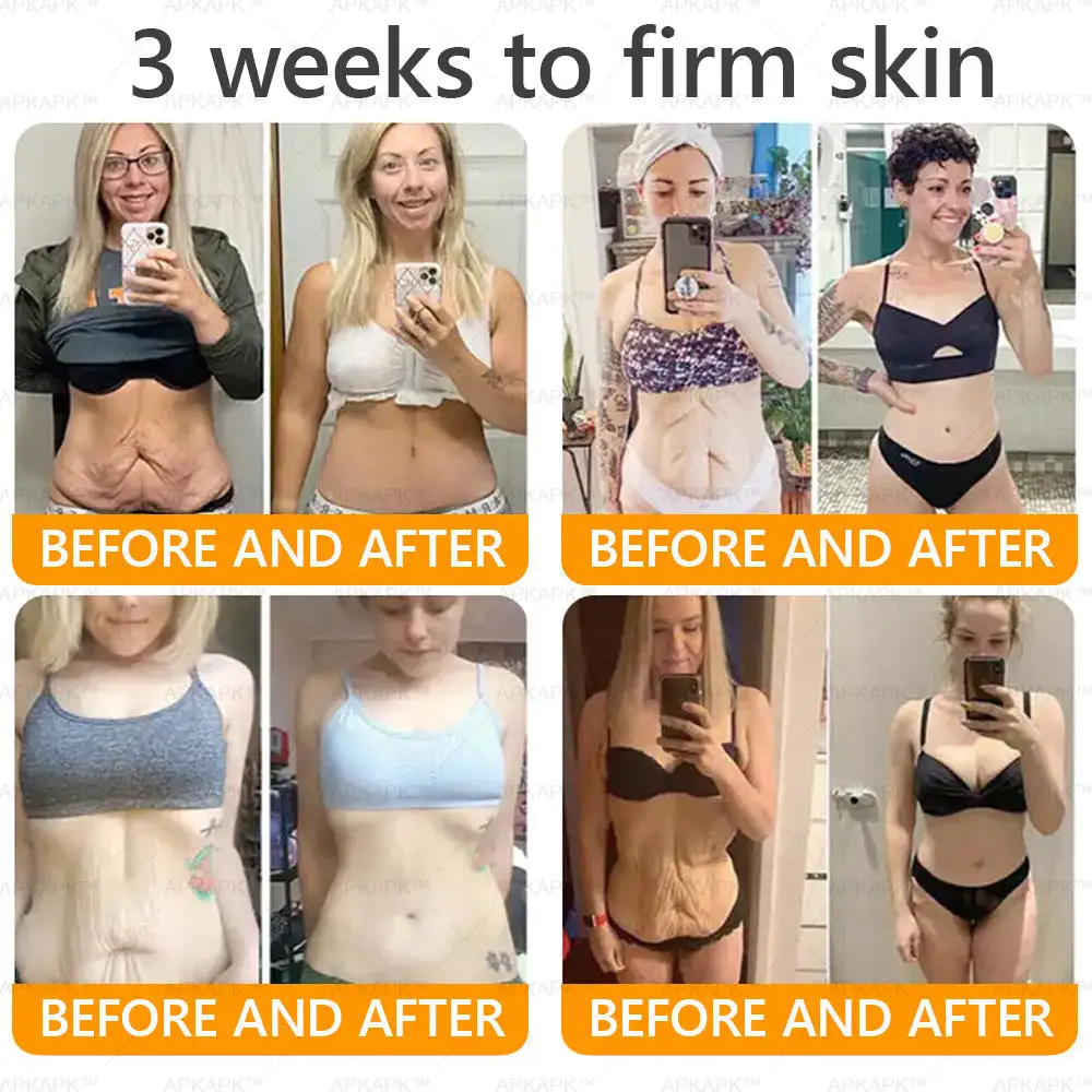 Bee venom Comprehensive Cream - Image 5