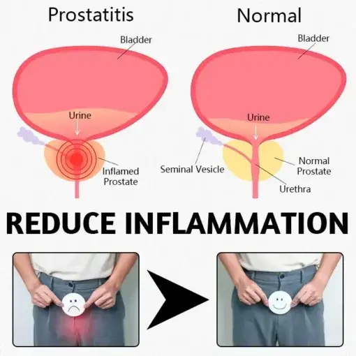 ProstaMagnetic Harmony Ring - Image 3