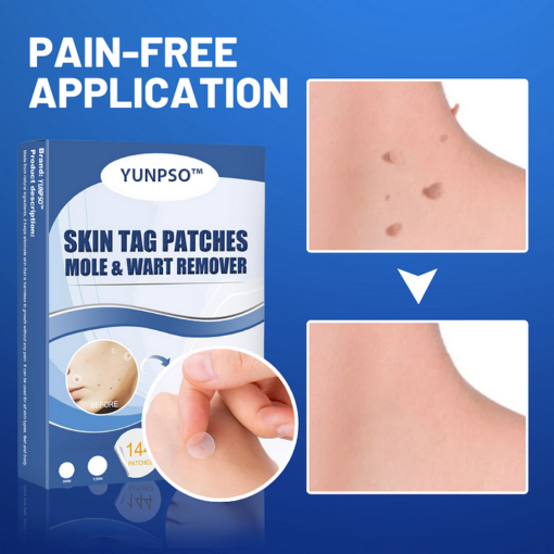 Moles & Warts Removing Skin Tag Patch