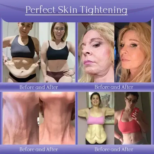 NATURA-LIFT Overnight Wrinkle Recovery Cream - Image 3