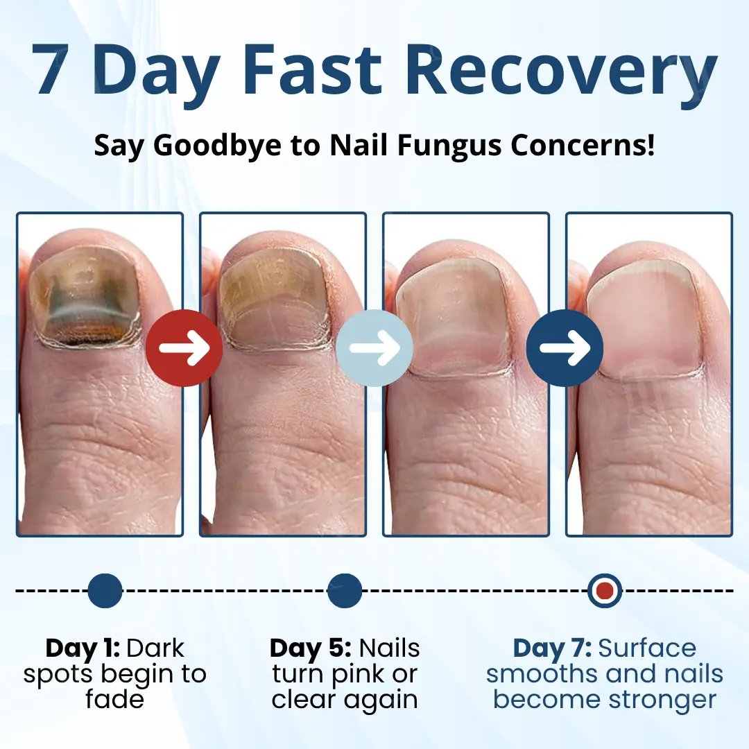 MycoShield Pro Fungal Nail Patches - Image 4