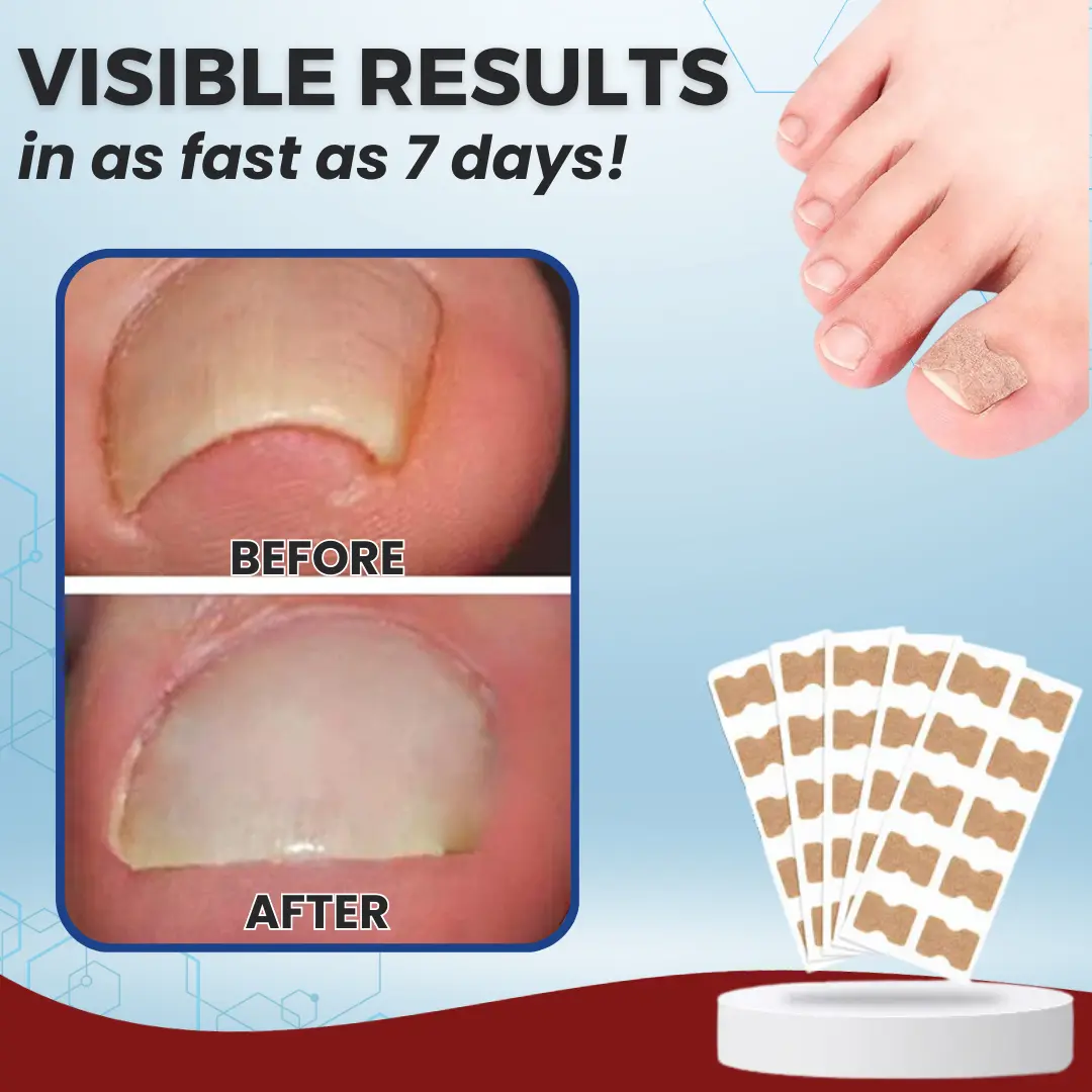 Paronychia Correcting Patch - Image 6