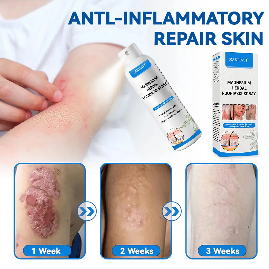 Magnesium Herbal Psoriasis Spray - Image 7