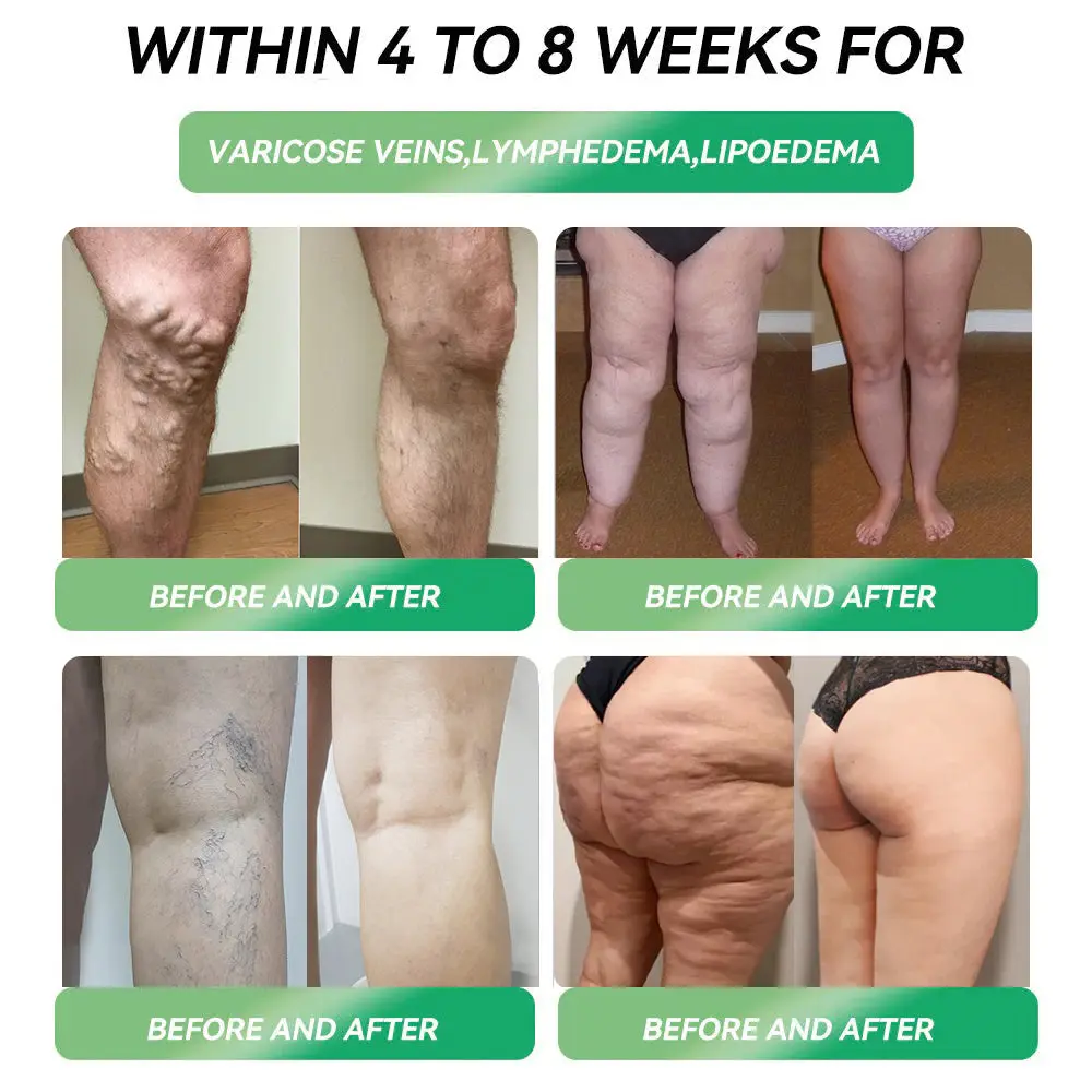 Telportide Oral Solution, GIP Dual-Action Weight Loss Solution - Image 4