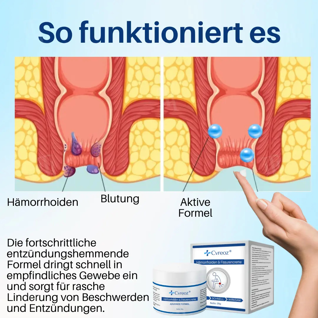 Hämorrhoiden & Fissurencreme - Image 5
