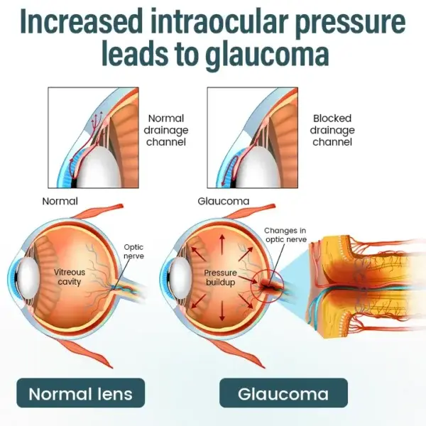 OptiFusion Nano Eye Drops Serum