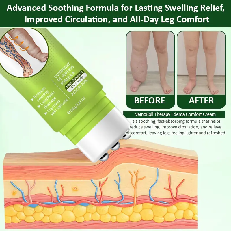 VeinoRoll Therapy Edema Comfort Cream - Image 6
