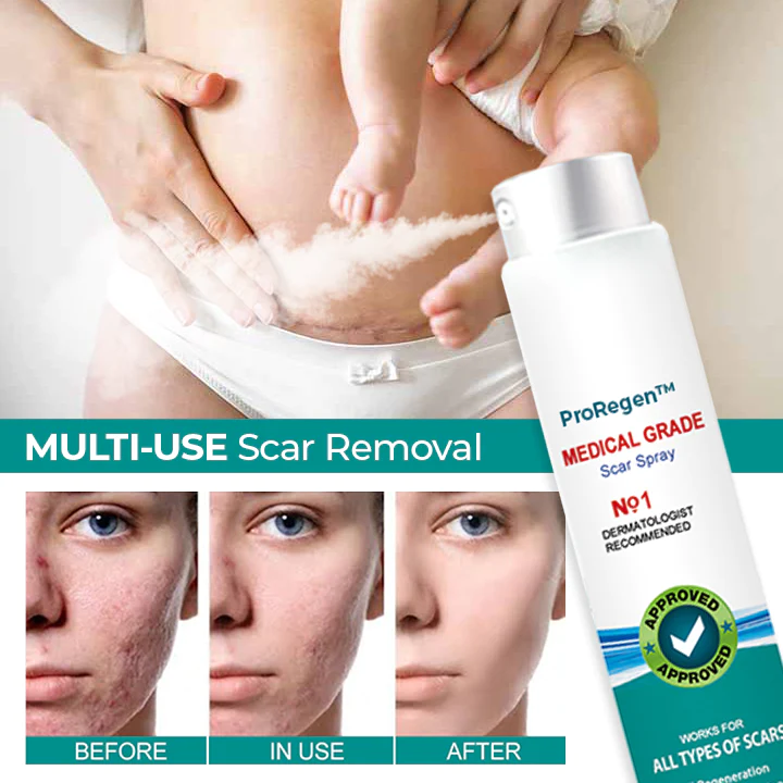 Medical Scar Removal Spray - Image 2