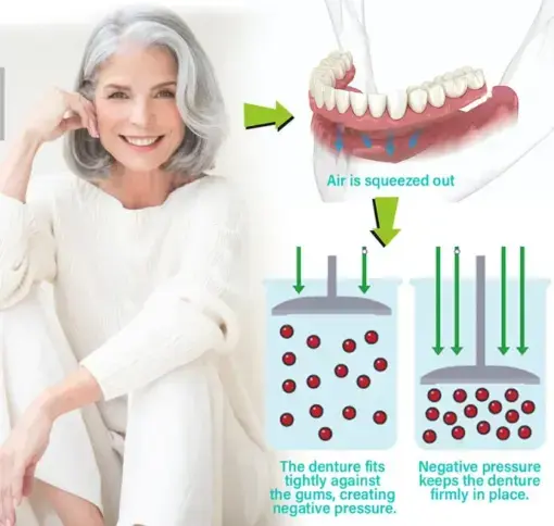 Immediate Dentures - Image 3