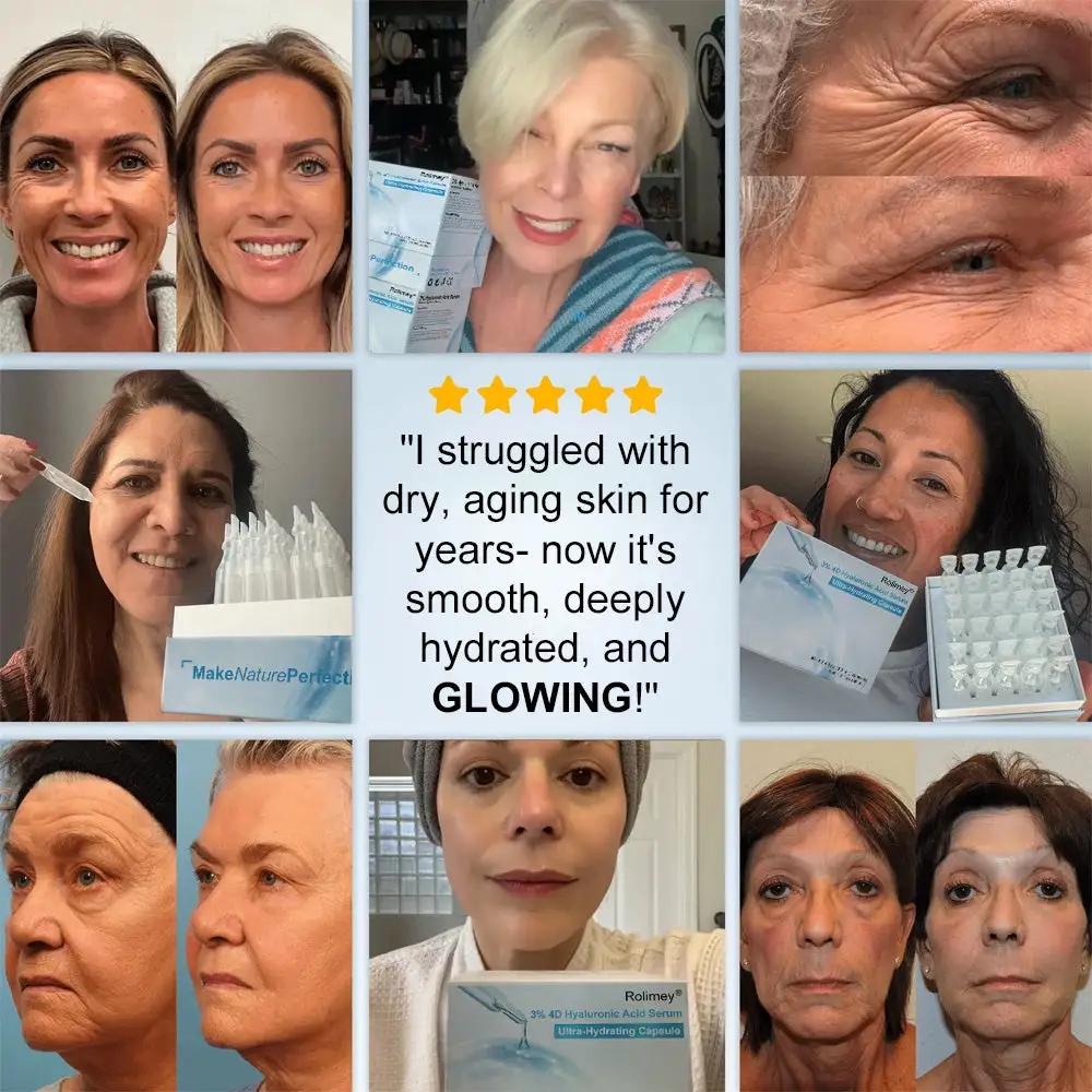 3% 4D Hyaluronic Acid Serum Ampoules - Image 3