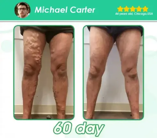 ๐ ๐ฒ๐๐ฎ๐ฏ๐ผ๐น๐ถ๐ฐ Support โ ๐จ๐น๐๐ฟ๐ฎ ๐๐ผ๐ป๐ฐ๐ฒ๐ป๐๐ฟ๐ฎ๐๐ฒ๐ฑ ๐๐ถ๐พ๐๐ถ๐ฑ ๐ฃ๐ฒ๐ฎ๐ฟ๐น๐ - Image 10