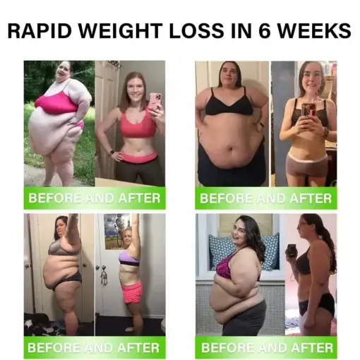 ๐ ๐ฒ๐๐ฎ๐ฏ๐ผ๐น๐ถ๐ฐ Support โ ๐จ๐น๐๐ฟ๐ฎ ๐๐ผ๐ป๐ฐ๐ฒ๐ป๐๐ฟ๐ฎ๐๐ฒ๐ฑ ๐๐ถ๐พ๐๐ถ๐ฑ ๐ฃ๐ฒ๐ฎ๐ฟ๐น๐ - Image 4