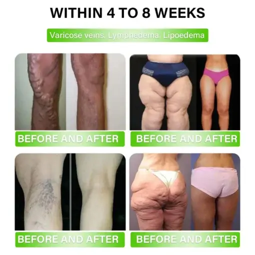 ๐ ๐ฒ๐๐ฎ๐ฏ๐ผ๐น๐ถ๐ฐ Support โ ๐จ๐น๐๐ฟ๐ฎ ๐๐ผ๐ป๐ฐ๐ฒ๐ป๐๐ฟ๐ฎ๐๐ฒ๐ฑ ๐๐ถ๐พ๐๐ถ๐ฑ ๐ฃ๐ฒ๐ฎ๐ฟ๐น๐ - Image 5