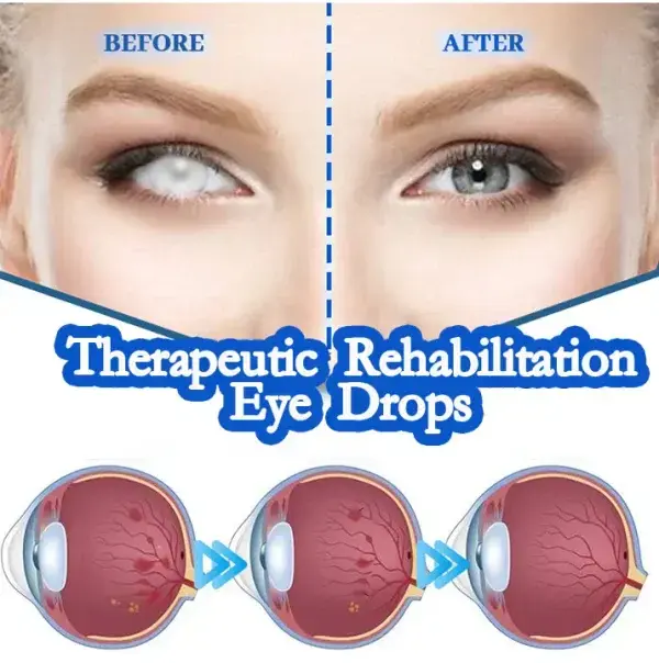 Vision recovery eye drops - Image 6