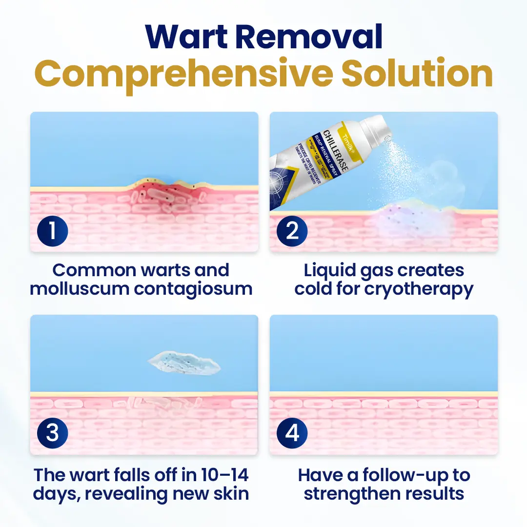 ChillErase Bump Renewal Spray - Image 4