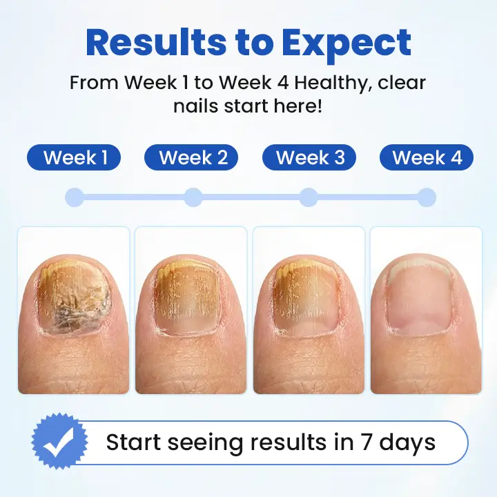 FungalPatch - Antibacterial Fungal Patch - Image 2