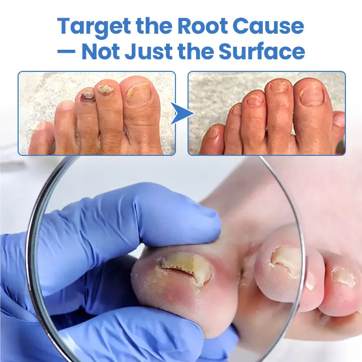 MycoErase Nail Revive Pen - Image 8