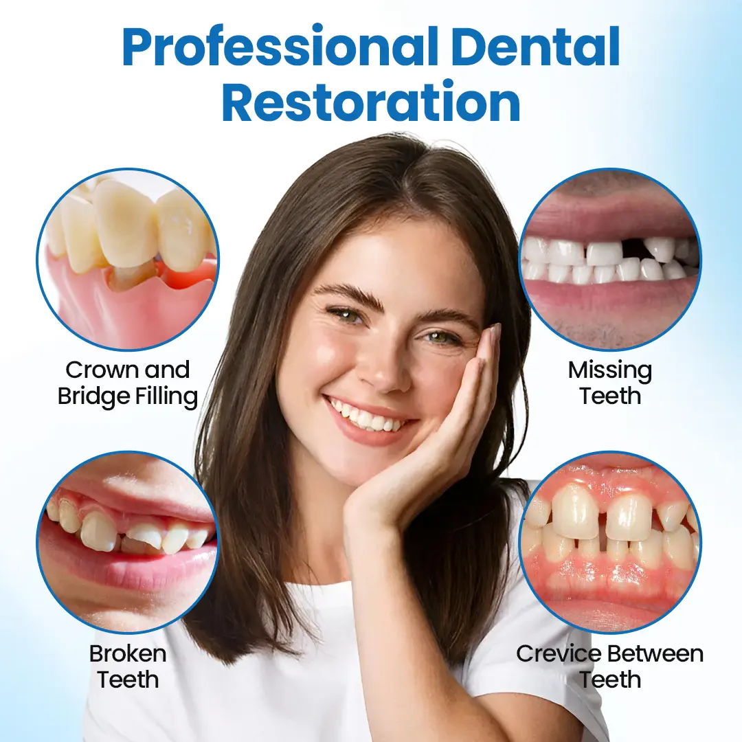 SmileMend Tooth Repair Filling Kit - Image 8