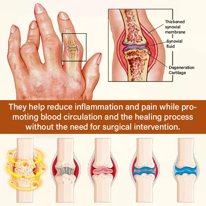 VenomEase Joint Cream - Image 11