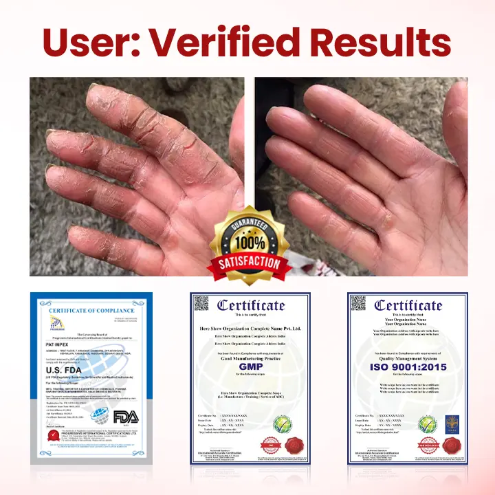 VitaGluco Diabetic Care Cream - Image 4