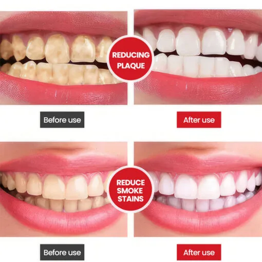 SP-6 Ultra+ Probiotic Whitening Toothpaste - Image 4