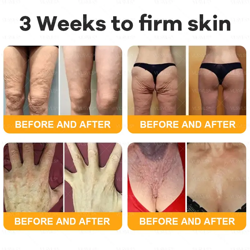 Bee Venom Skin Restoration Cream - Image 3