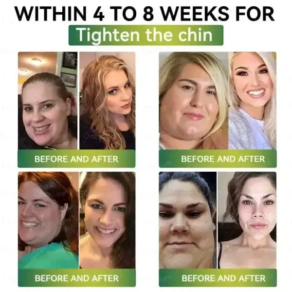 Weight Loss Oral Solution