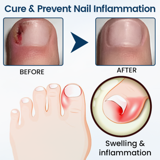 OnyxiGuard Fungal Repair Herbal Spray - Image 2