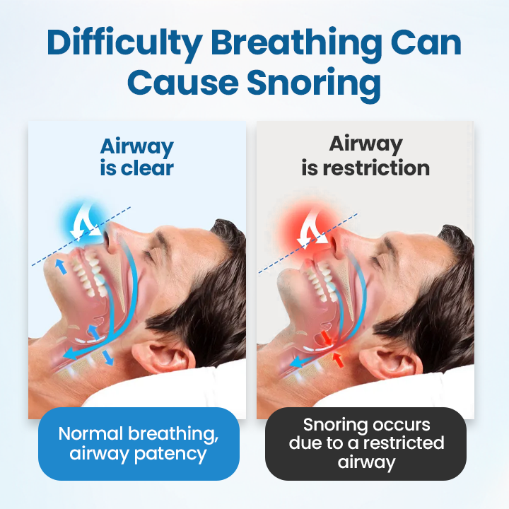 SnoreLess Nasal Breather - Image 5