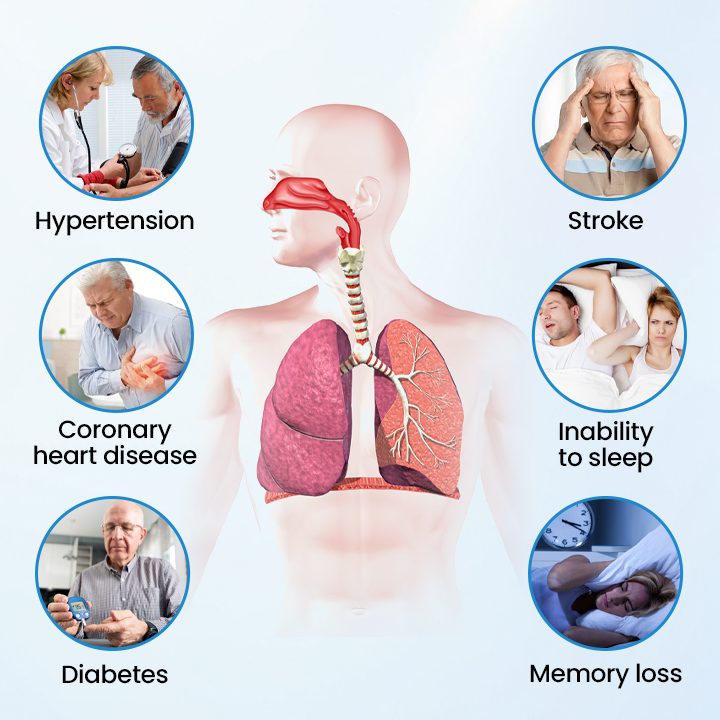 SnoreLess Nasal Breather - Image 3