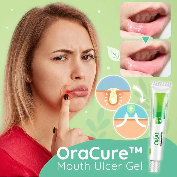 Mouth Ulcer Gel