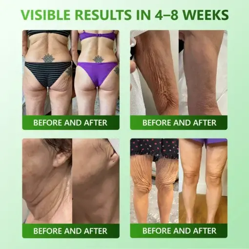 ๐
๐ข๐ซ๐ฆ๐ข๐ง๐ & ๐๐ง๐ญ๐ข-๐๐ซ๐ข๐ง๐ค๐ฅ๐ ๐๐ญ๐๐ฆ ๐๐๐ฅ๐ฅ ๐๐จ๐ฅ๐ฅ๐๐ ๐๐ง ๐๐ซ๐จ๐ฉ๐ฌ - Image 3